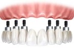 proteses-av-faria-lima-1355864856